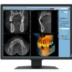 Monitor Eizo 21" MX217-SB